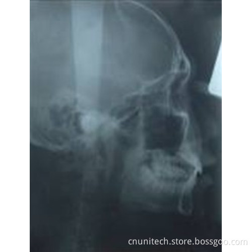Digital Panoramic Dental X-ray Machine